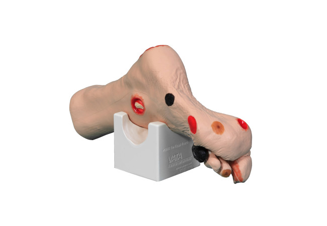 G-CM2718-Wilma-Wound-Foot-Model
