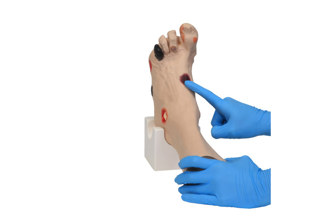G-CM2718-Wilma-Wound-Foot-Model